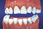 Orthodontic Services